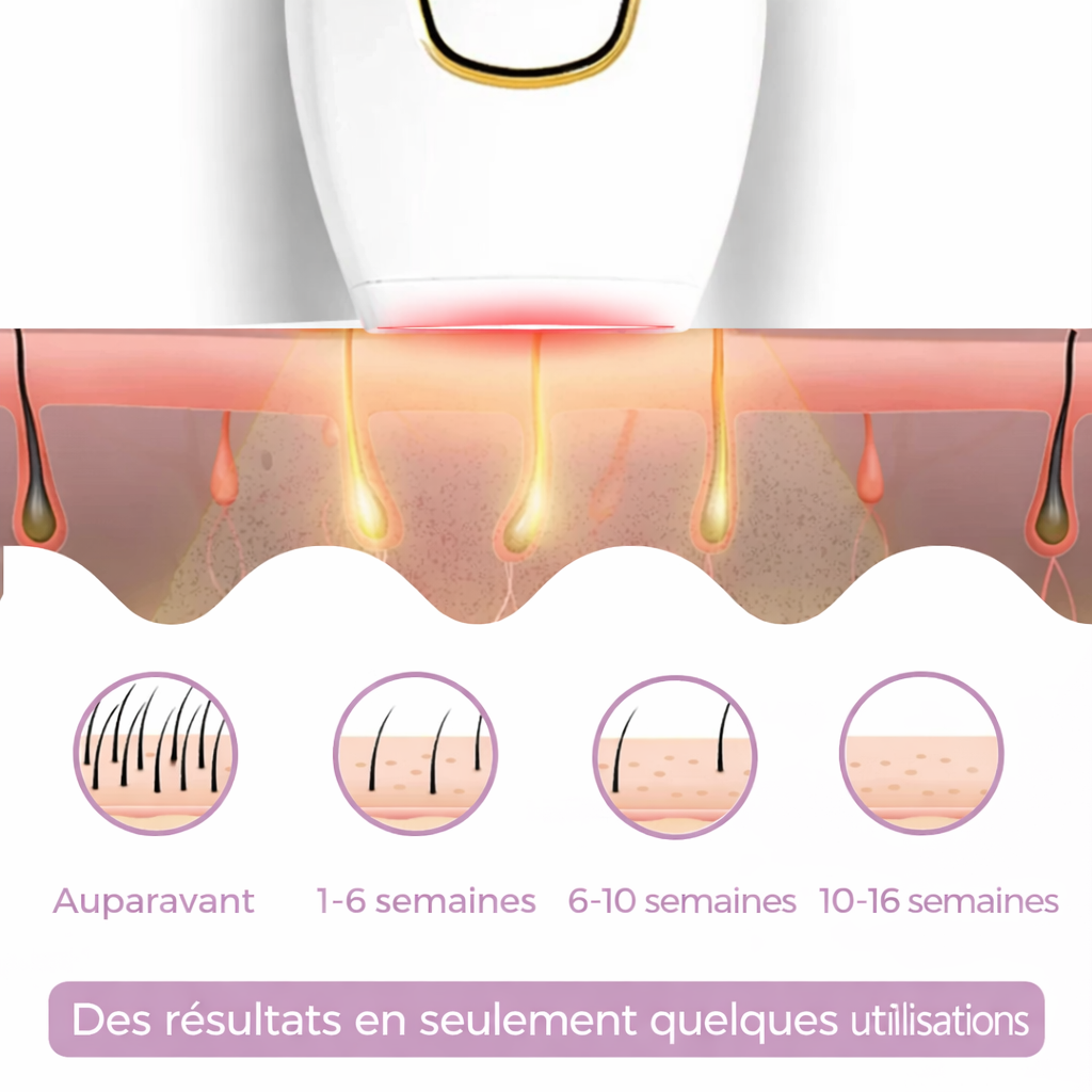 Luvéra Épilateur IPL | La meilleure épilation au laser à domicile