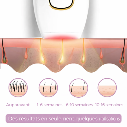Luvéra Épilateur IPL | La meilleure épilation au laser à domicile
