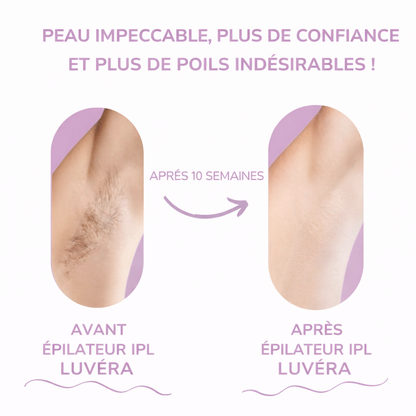 Luvéra Épilateur IPL | La meilleure épilation au laser à domicile