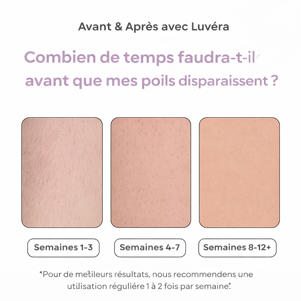 Luvéra Épilateur IPL | La meilleure épilation au laser à domicile
